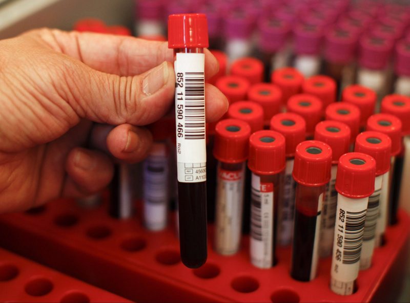 apex laboratory ransomware